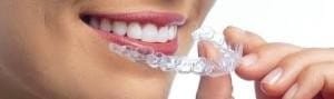 orthodontictherapy_002