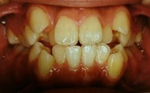 orthodontictherapy_007