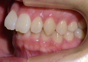 orthodontictherapy_009