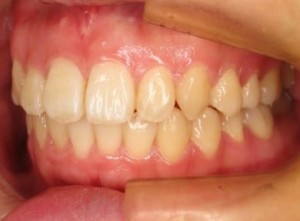 orthodontictherapy_010