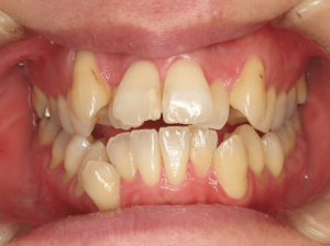 orthodontictherapy_011