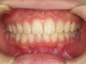 orthodontictherapy_014