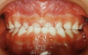orthodontictherapy_015