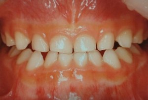 orthodontictherapy_016