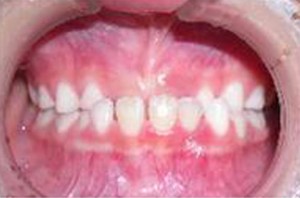 orthodontictherapy_019
