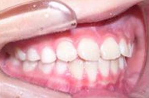 orthodontictherapy_022