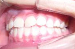 orthodontictherapy_024