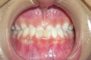 orthodontictherapy_028