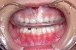 orthodontictherapy_029