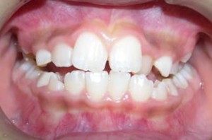 orthodontictherapy_049