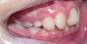 orthodontictherapy_055