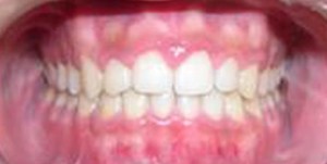orthodontictherapy_076
