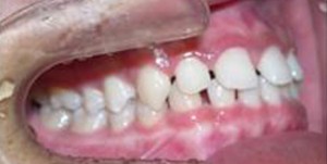 orthodontictherapy_078