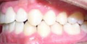 orthodontictherapy_081