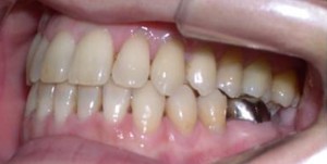orthodontictherapy_083