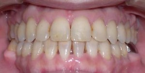 orthodontictherapy_085