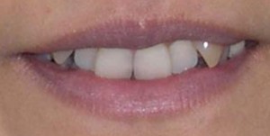 orthodontictherapy_090