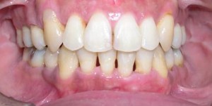 orthodontictherapy_093