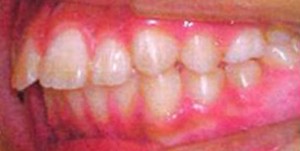 orthodontictherapy_096