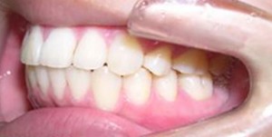 orthodontictherapy_097