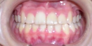orthodontictherapy_101