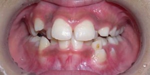orthodontictherapy_104