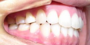 orthodontictherapy_117