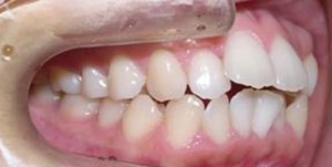 orthodontictherapy_118