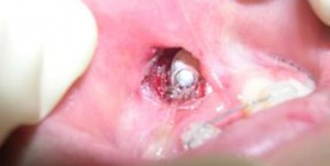 orthodontictherapy_120