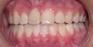 orthodontictherapy_123