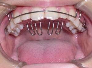 orthodontictherapy_128
