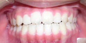 orthodontictherapy_129