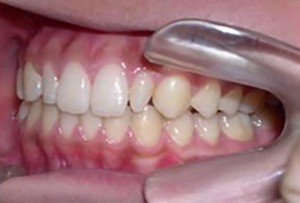 orthodontictherapy_135