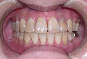 orthodontictherapy_137