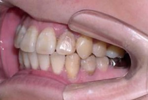 orthodontictherapy_139