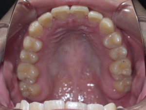 orthodontictherapy_300