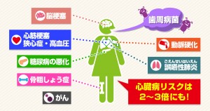 【イラスト③】SDN_2101_歯周病が招く全身の病気